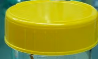 Tăm xỉa răng dài 6cm đâm thủng ruột bé trai 14 tuổi