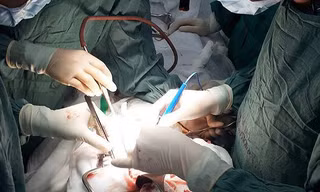 Người đàn ông bị gỗ đập vỡ tim
