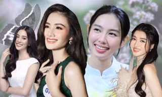 Dàn hậu Việt "lột xác" nhờ niềng răng: Tiểu Vy đạt tỷ lệ vàng, Đỗ Thị Hà mặt nhỏ hơn
