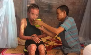 Trường ĐH Văn Hiến kêu gọi ủng hộ cho sinh viên bị bệnh nặng