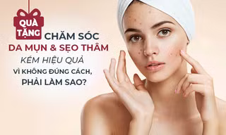 Quà tặng: Da bị mụn và sẹo thâm nên làm gì để “chấm dứt” vĩnh viễn tháng ngày “u tối”?