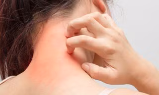 Ngứa da điên cuồng, có thể bạn đã mắc phải một trong các 'bệnh trọng' sau