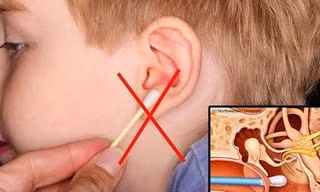 Bỏ ngay những cách lấy ráy tai sai lầm này kẻo điếc vĩnh viễn