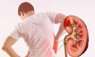 Những sai lầm khi ăn uống khiến thận phải ‘kêu cứu’, ai cũng ít nhất một lần mắc phải