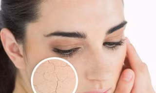 Mùa lạnh hanh khô nên ăn những thực phẩm này bởi giữ ẩm cực tốt