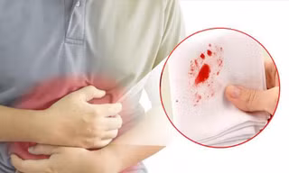 Bất ngờ chảy máu từ những vị trí này, rất có thể bạn đã bị ung thư