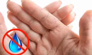 Bất thường ở bàn tay tiết lộ gì về sức khỏe?