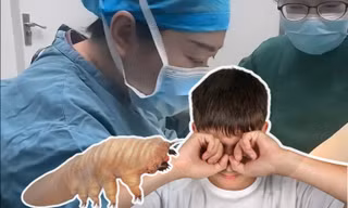 Trung Quốc: Dụi mắt cho "đã", hơn 80 con ve "làm tổ" trong mắt cậu bé 13 tuổi