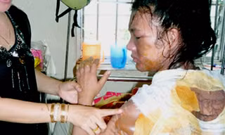 Chồng tạt nước sôi lên vợ vì bị đòi ly dị