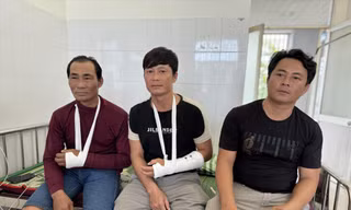 Ngư dân Nguyễn Thanh Biên (bìa phải) thuyền trưởng tàu cá QNg 95739 TS, bị đánh với nhiều vết bầm trên người. Ảnh: NN