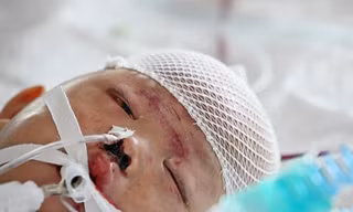 Bé gái hai tuổi bị xe tải đâm đang hồi phục