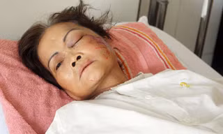 Trên đường ra đám tang đứa con trai vừa qua đời, bà Xéc bị tai nạn. Ảnh:An Nhơn.