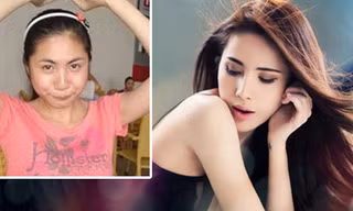 Sao Việt và những hậu quả làm đẹp