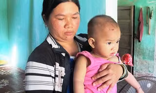 Bé gái bị liệt tay do hộ sinh đỡ ngược khi đẻ?
