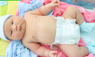 Bé trai chào đời có cân nặng 'khủng' ở Bình Phước