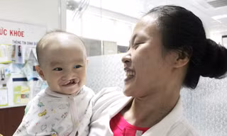 Dự kiến 300 trẻ bị khe hở môi, vòm miệng sẽ được phẫu thuật miễn phí trong tháng 10. 
