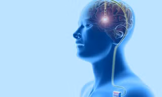 Phẫu thuật não để cai nghiện ma túy đá được thực hiện như thế nào?