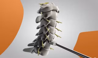 Cấy ghép đĩa đệm cổ nhân tạo tại Mỹ
