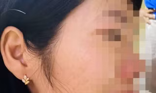 Vụ phụ huynh đánh cô giáo vì con hạnh kiểm trung bình: Xem xét kỷ luật