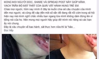 Đại diện Cục trẻ em lên tiếng vụ nữ sinh tố MC Minh Tiệp bạo hành