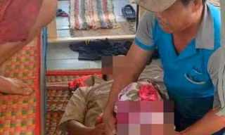 Tàu tuần tra cứu giúp ngư dân bị tai nạn mất chân trên biển