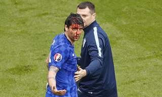 Corluka sau pha va chạm với Tosun.