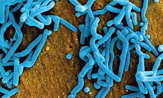 Virus Marburg gây tử vong cao nhưng không dễ lây 