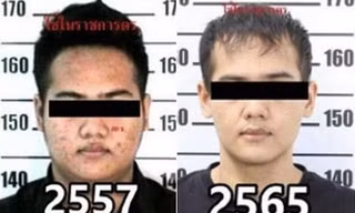 Tay buôn ma tuý Sarahat Sawangjaeng trước và sau khi phẫu thuật