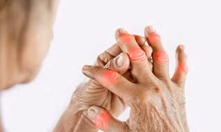 Pháp – Việt phối hợp tìm giải pháp trị dứt điểm bệnh gút