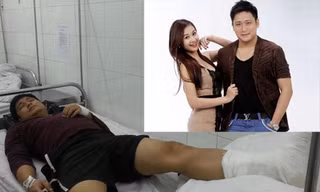 Minh Tiệp ngã ngựa ngay trước đêm diễn CĐHH