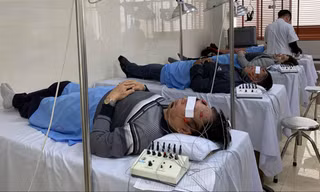 Châm cứu chữa liệt mặt vì lạnh cho bệnh nhân