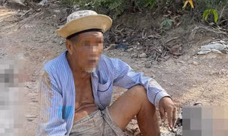 Truy tìm chiếc xe tông dập nát hai bàn chân cụ ông 85 tuổi rồi bỏ trốn