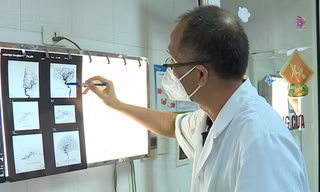Mù mắt, co giật, tắc động mạch não vì tiêm filler làm đẹp mũi