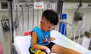 Cấp cứu bé 3,5 tuổi chấn thương đầu mặt cổ, bị cho vào thùng giấy, nhốt trong tủ cấp đông