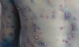 Ảnh minh họa.