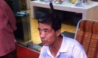  Ông Xiao bị dao cắm vào đầu. (Nguồn: CCTV) 