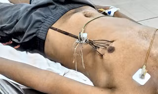 Bệnh nhân Nguyễn Phúc Duy lúc mới nhập viện.