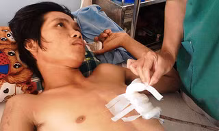 Can cuộc xô xát, người đàn ông bị đâm thủng tim