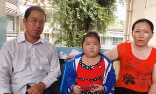 Mờ mắt sau mổ