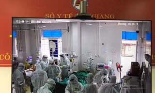 Các y bác sĩ Bệnh viện Chợ Rẫy đặt ECMO cho bệnh nhân 61 tuổi sáng 1/6. Ảnh: BS cung cấp