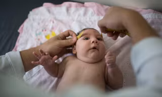 Virus zika gây dị tật đầu nhỏ bẩm sinh đang hoành hành ở châu Mỹ Latinh