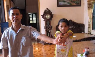 Về lại nơi trẻ bị bệnh gồ vai, 'sệ cánh'