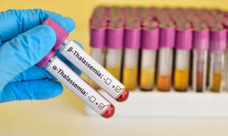 Ngăn chặn bệnh Thalassemia để không ảnh hưởng giống nòi 