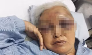 Bà Chả đang điều trị trong bệnh viện.