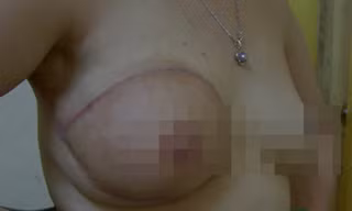 Bị cắt 'của quý' vì ung thư vẫn dùng tốt