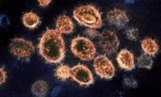 Virus SARS-CoV-2 - một loại virus corona gây bệnh COVID-19. Ảnh: CNN
