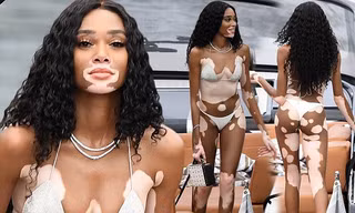 Siêu mẫu Winnie Harlow diện bikini nhảy múa trên du thuyền triệu đô