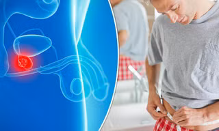 Làm thế nào phát hiện sớm ung thư tuyến tiền liệt?