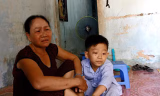 Bà Nam bức xúc vì cháu mình bị cô giáo đánh tím đùi