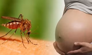 TPHCM: đã có 69 trường hợp nhiễm virus Zika